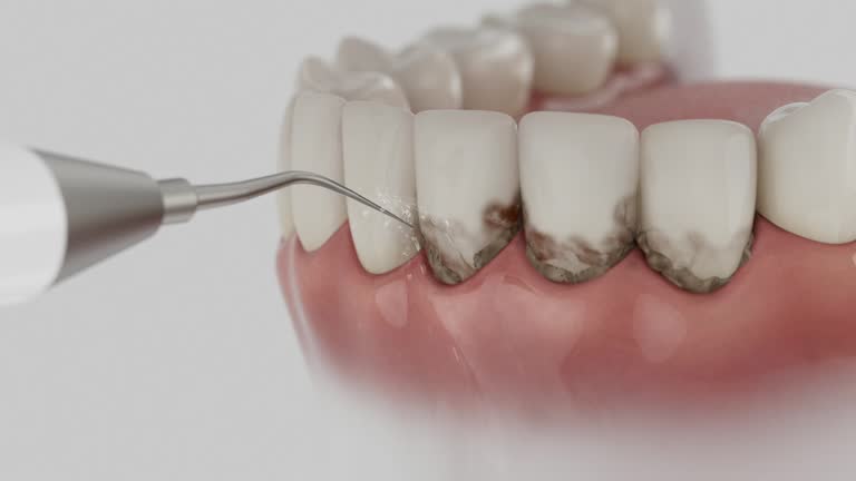 Trusted Emergency Dentist service in Lilburn, GA - Dentist Open Now